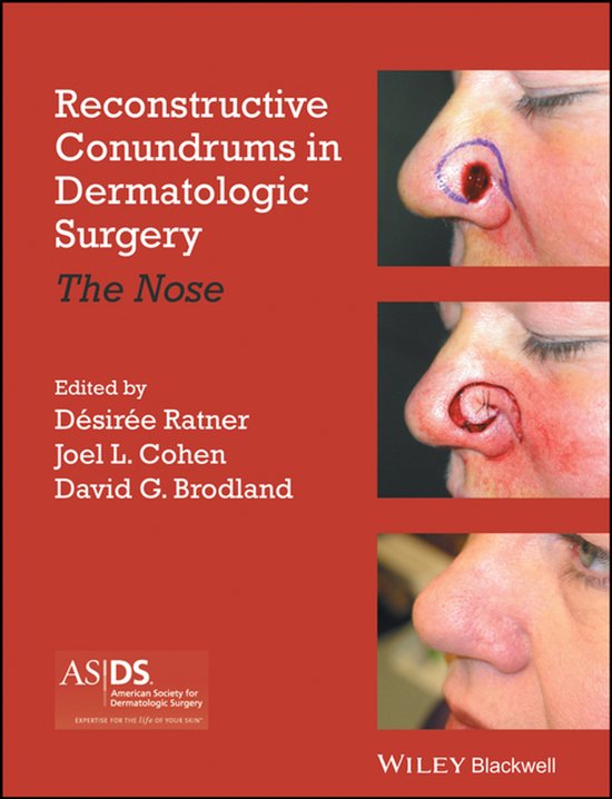 Reconstructive Conundrums in Dermatologic Surgery - cover