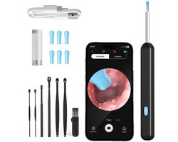 Edmondo Oorsmeerverwijderaar met Camera - Oorsmeer verwijderaar - Oorreiniger – Ear Cleaner – Oren Schoonmaken – Oorspuit - Oorcamera – Oorlepel - Earscratcher - Ultra HD Camera - Inclusief reinigingsset - Zwart - USB Oplaadbaar