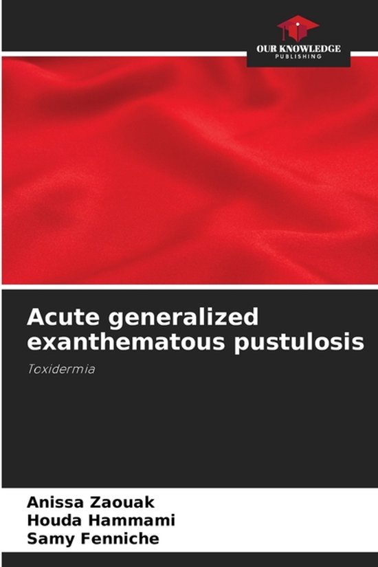Acute generalized exanthematous pustulosis