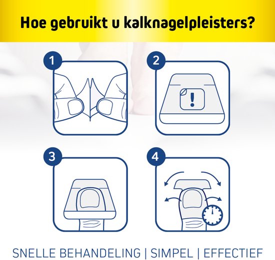 FungeX Kalknagel Pleister - Voetschimmel Behandeling - Alternatief Voetschimmel Creme - Zwemmerseczeem Behandeling - Schimmelnagel - Kalknagelbehandeling