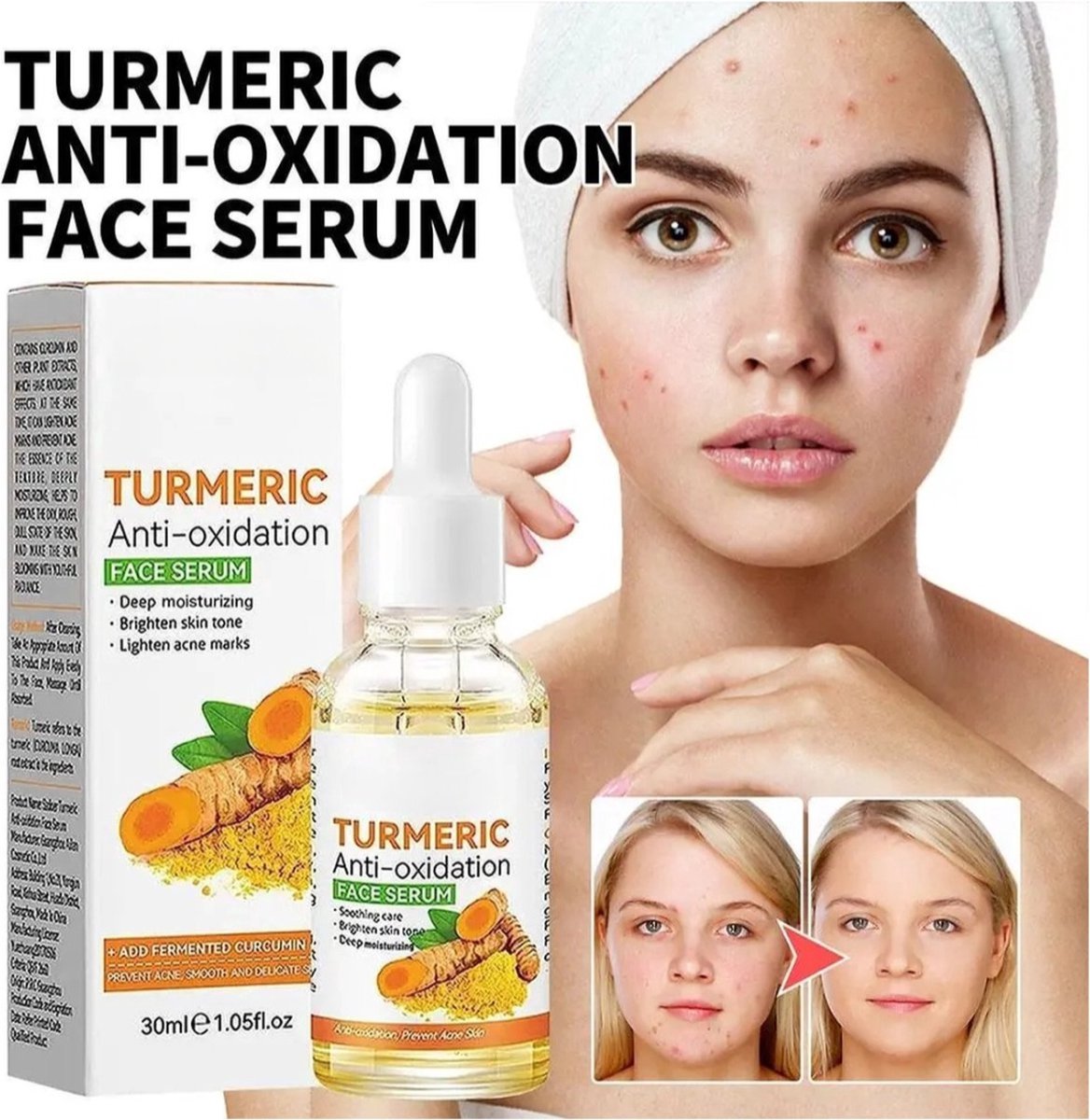 Goedkoopste Zeer effectieve kurkuma olie serum voor anti aging, verminderd huidveroudering, vlekken huiduitslag acne met natuurlijke ingredienten