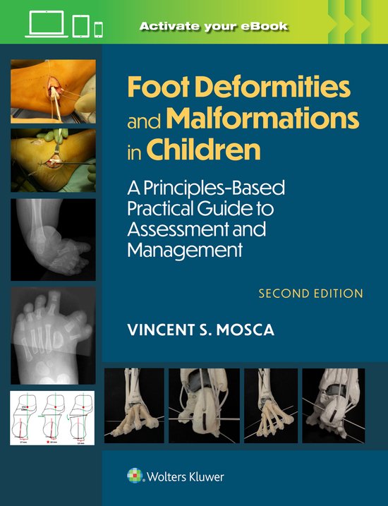 Foot Deformities and Malformations in Children - cover
