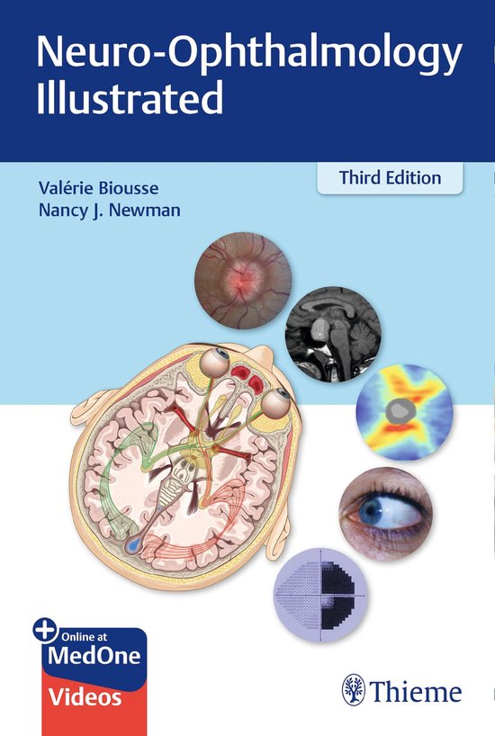 Neuro-Ophthalmology Illustrated - cover