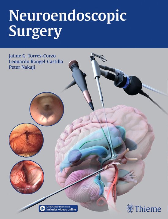 Neuroendoscopic Surgery - cover