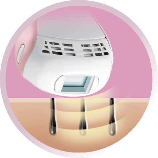 IPL6750 iLIGHT Prestige