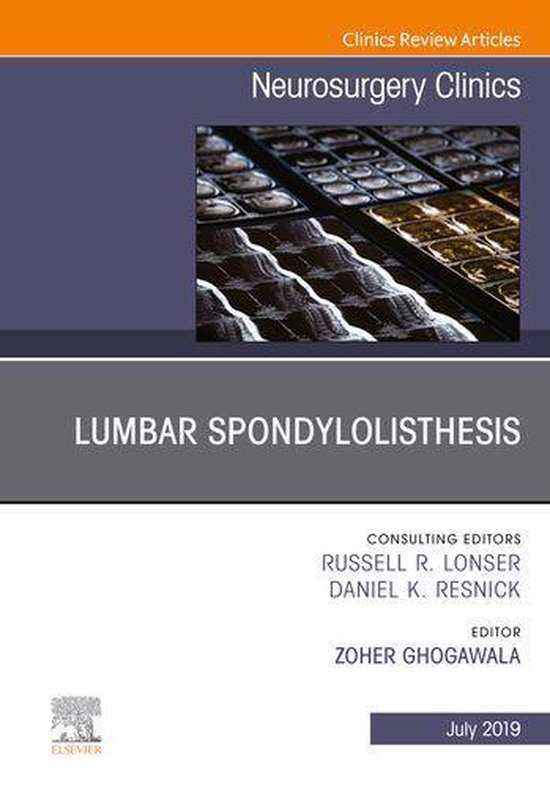 The Clinics: Surgery Volume 30-3 - Lumbar Spondylolisthesis, ... - cover