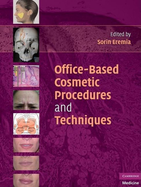 OfficeBased Cosmetic Procedures and Techniques (ebook), Sorin Eremia 9780511669507...