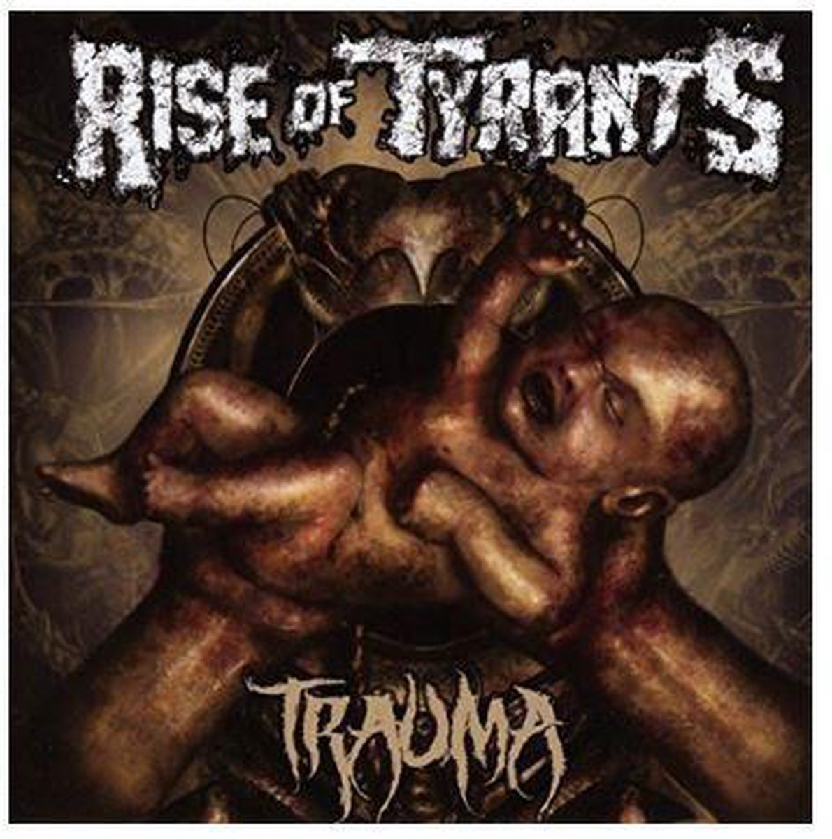 Trauma