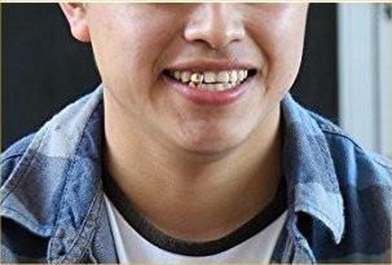 Jonge man met een geborduurd shirt die lacht, met een gouden grillz op zijn voortand.