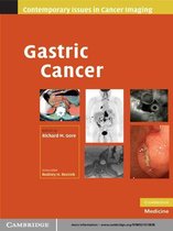 Contemporary Issues in Cancer Imaging -  Gastric Cancer