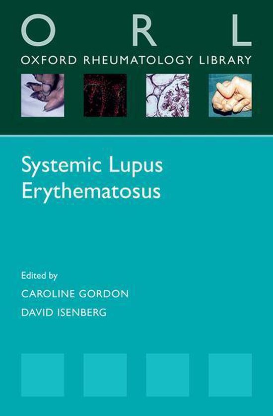 Erythematosus systemic lupus Lupus (Systemic
