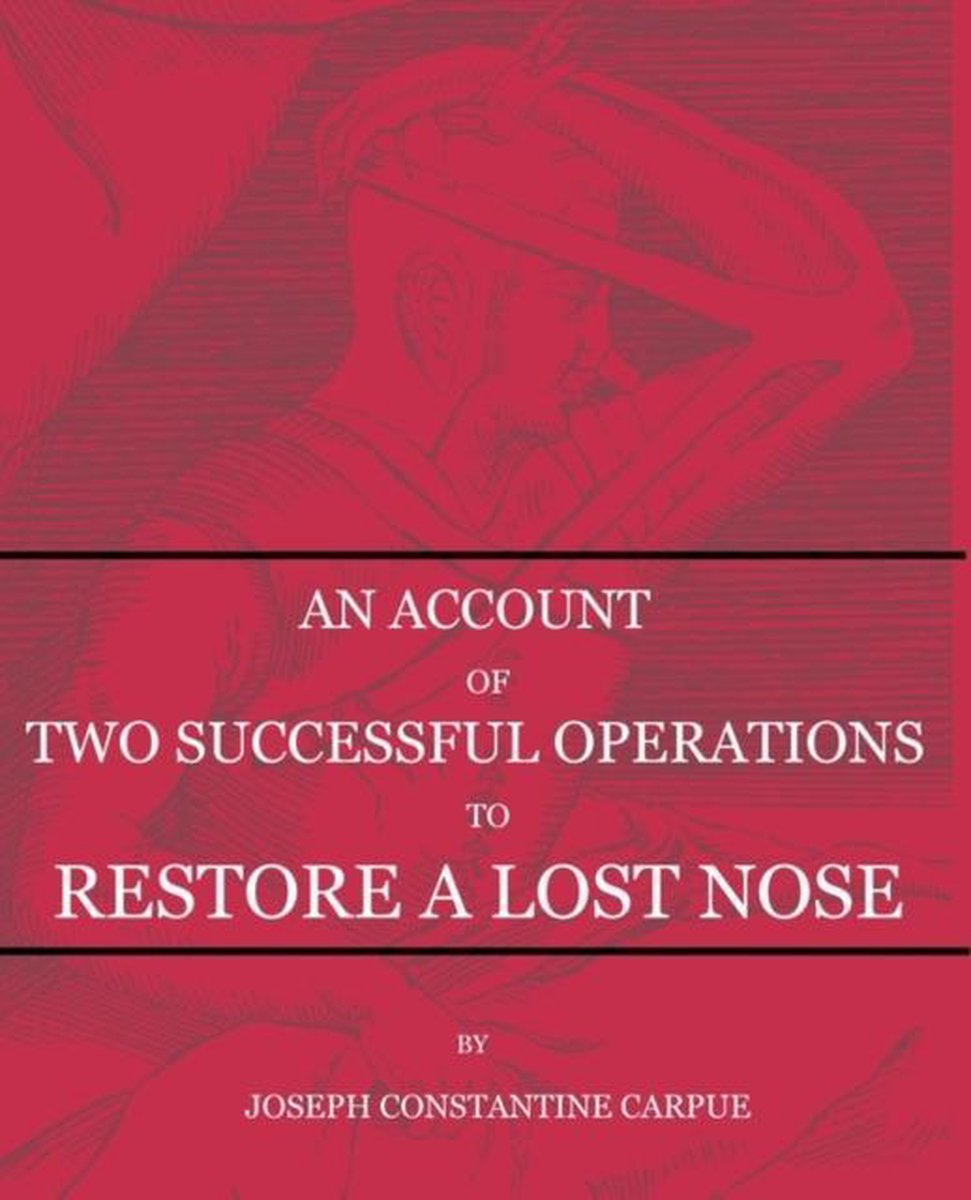 An Account of Two Successful Operations for Restoring a Lost Nose - Joseph Constantine Carpue