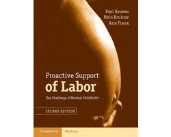 Proactive Support of Labor