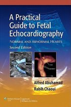 Practical Guide To Fetal Echocardiography