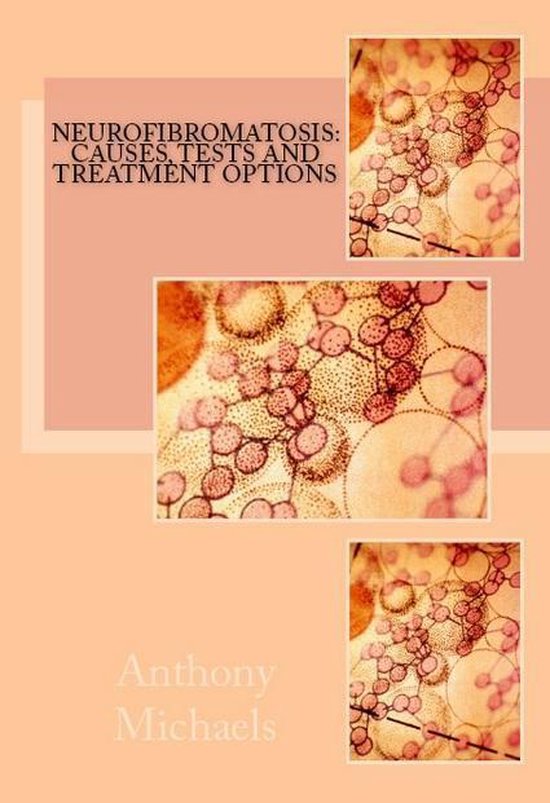 Neurofibromatosis: Causes, Tests and Treatment Options - cover
