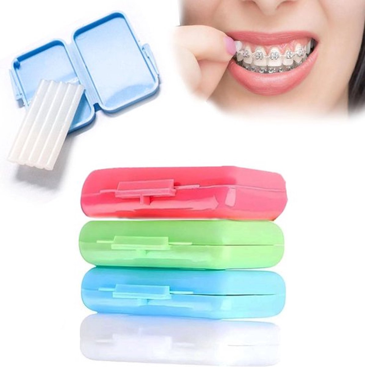 Orthodontische Was voor Beugels, Verlicht Irritatiepijn - 4 Doosjes - Tandtechnische Was