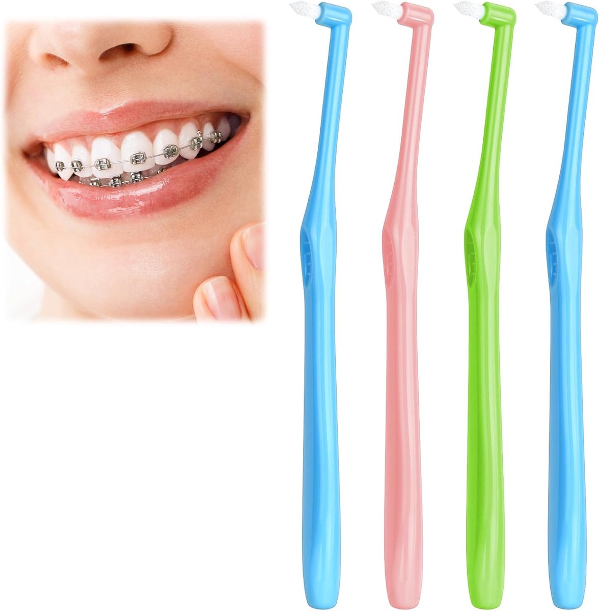 carmdering - Einbüschelbürste - Single Tuft Brush - Interdental Bürste - Präzise Detailreinigung - Sanfte Zahnfleischpflege - Nylon Borsten - Ergonomischer Griff - Ideal Für Zahnspangen - 4 Stück