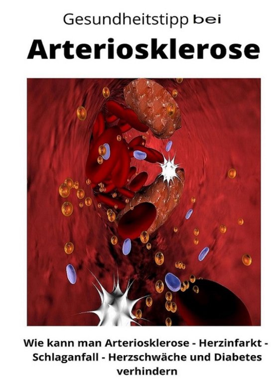 Gesundheitstipp bei Arteriosklerose - cover