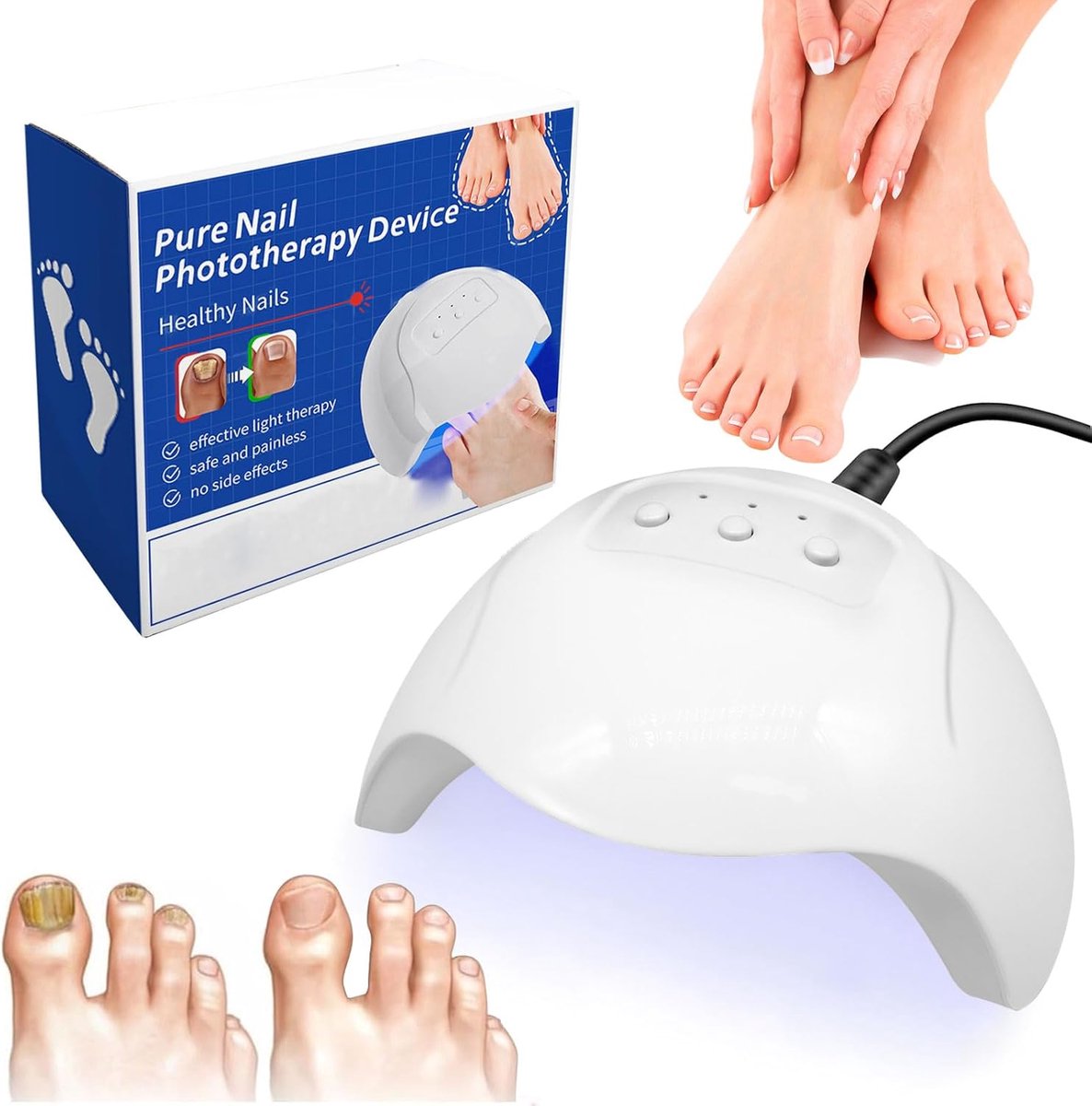 Lichttherapie Nagelapparaat - Nagelschimmel Behandeling - Intensieve Verzorging - Draagbaar Oplaadbaar - 19.6 x 17.9 x 10.1 cm