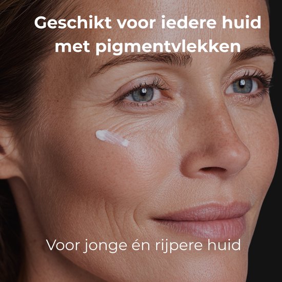 Skinlight Anti Pigment Creme - Melasma Creme - Hyperpigmentatie - Pigmentvlekken Verminderen - Ouderdomsvlekken - Brightening Cream - 60 ml