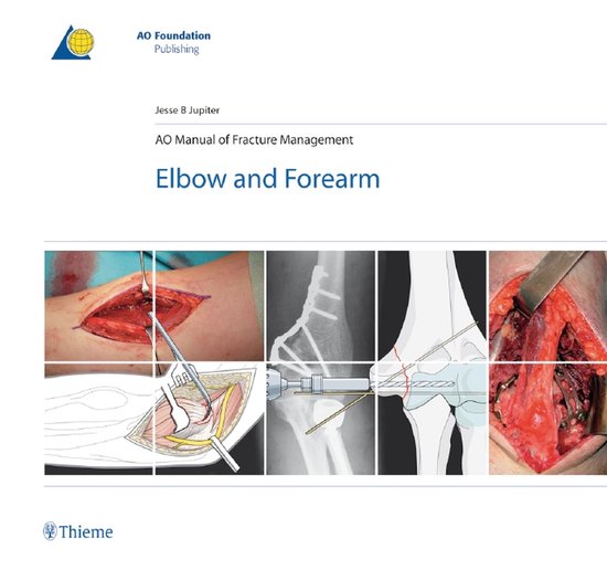 AO-Publishing - AO Manual of Fracture Management - Elbow and ... - cover