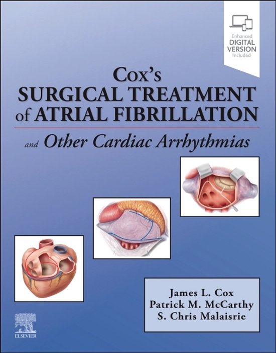 Cox's Surgical Treatment of Atrial Fibrillation - cover