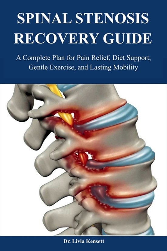 Spinal Stenosis Recovery Guide: A Complete Plan for Pain Relief, Diet ...