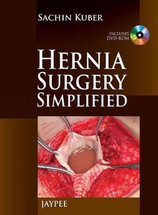 Hernia Surgery Simplified 9789350259498 Sachin Kuber Boeken