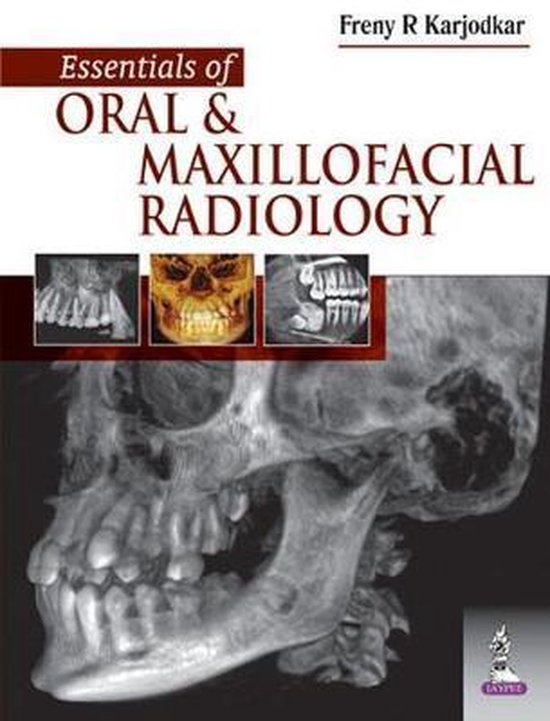 Essentials of Oral and Maxillofacial Radiology 9789351522294 Freny R Karjodkar