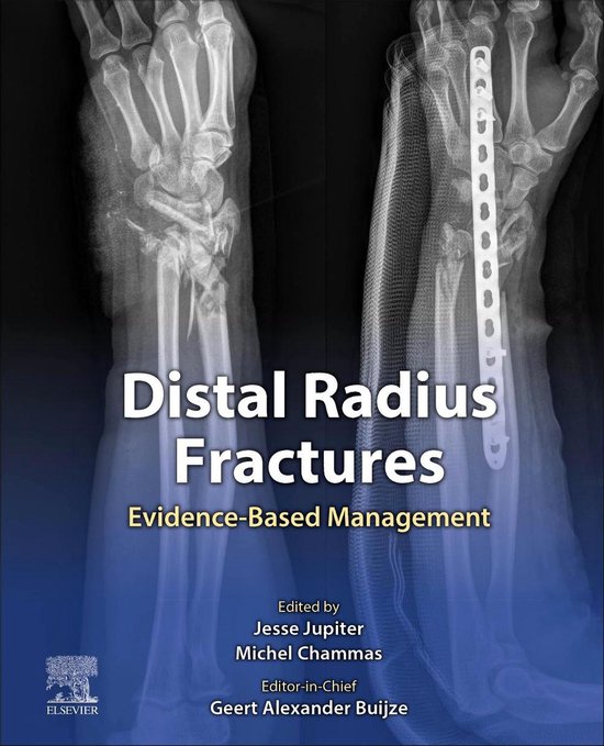 Distal Radius Fractures - cover