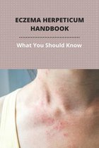 Eczema Herpeticum Handbook: What You Should Know