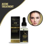 SEZGoods Acne Serum - Skincare - Acne Behandeling - Pigmentvlekken Verwijderen