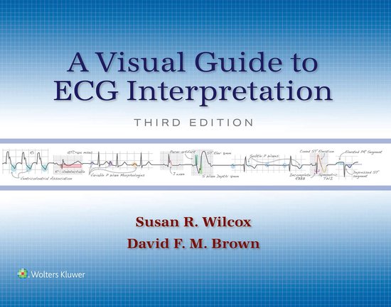 A Visual Guide to ECG Interpretation (ebook), Susan R. Wilcox ...