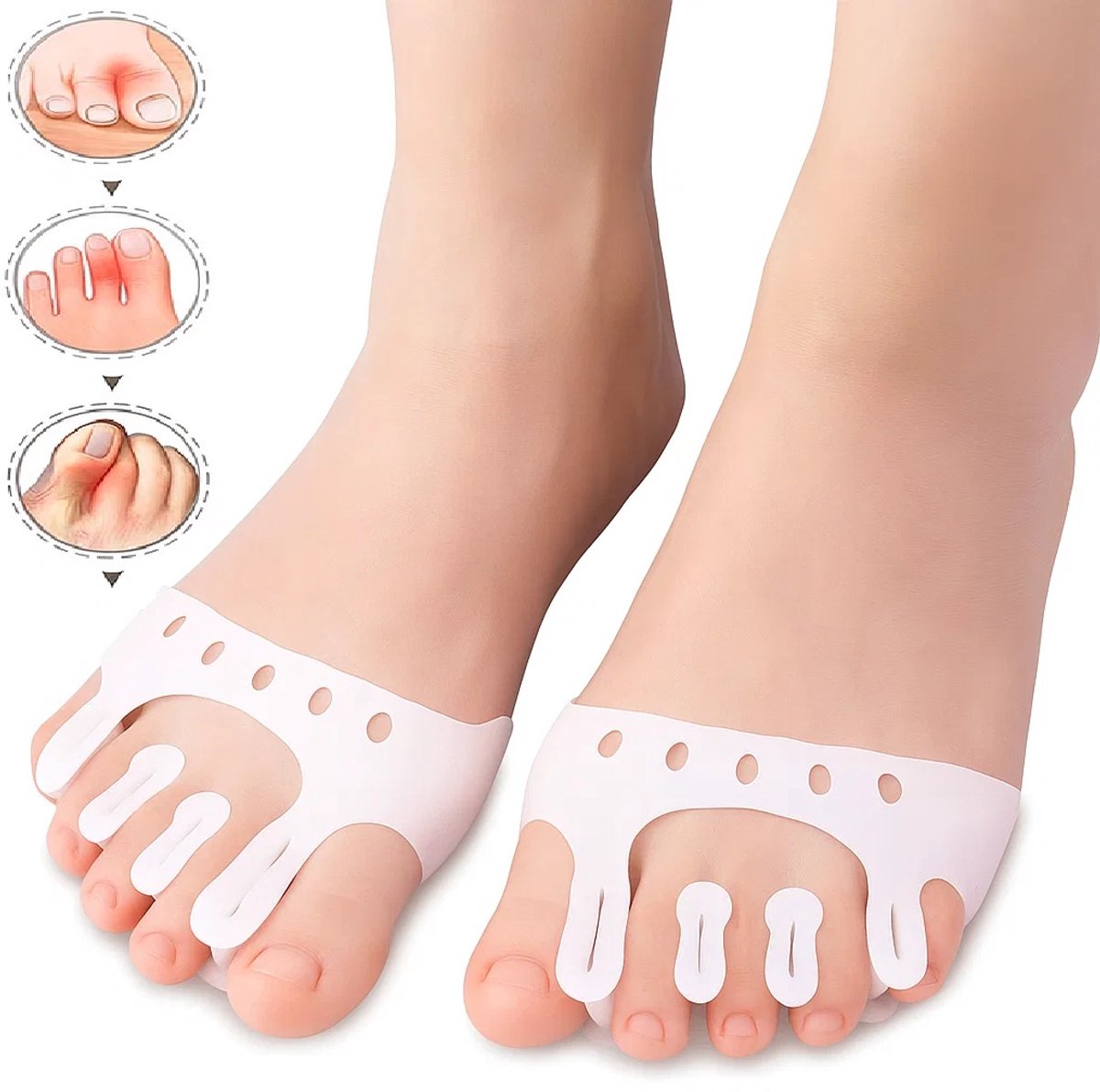 Siliconen Teencorrector 5 Gaats I Teenspreider I Hallux Valgus I Teen Recht Maken I Schok Absorberend I Met Gaten I Wit I 1 Paar