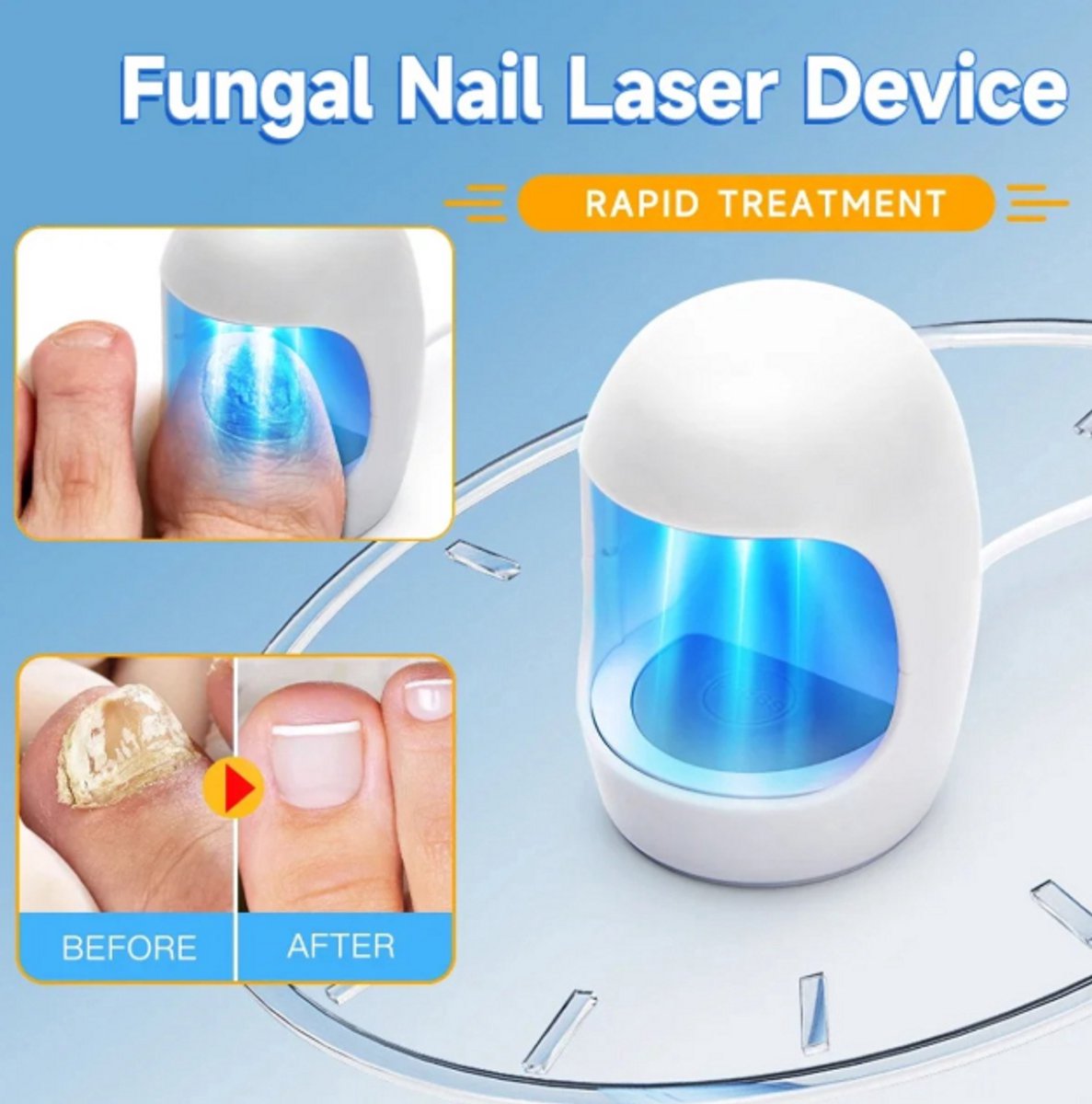 Nagelschimmelbehandelingsapparaat – LED Licht voor Beschadigde, Verkleurde en Dikke Teennagels & Vingernagels, Remedie tegen Nagelschimmelinfectie, Voetverzorging, Nagelverzorging, Antischimmel Behandeling