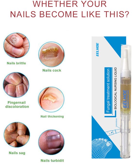 Hypogeen Handcrème - hypoallergeen - PH-neutraal - tegen ruwe
