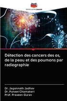 Detection des cancers des os, de la peau et des poumons par radiographie