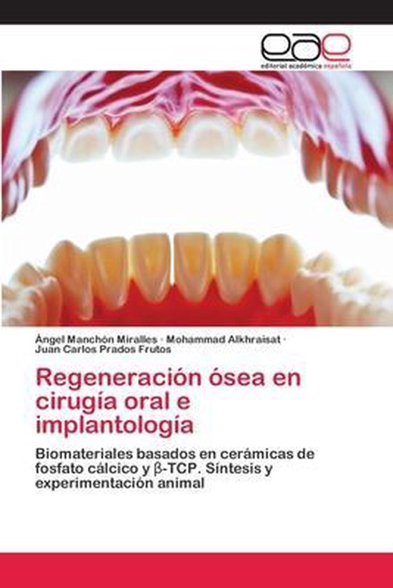 Foto: Regeneraci n sea en cirug a oral e implantolog a