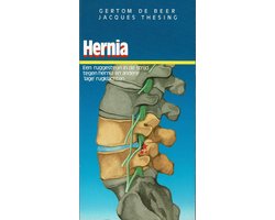 Hernia