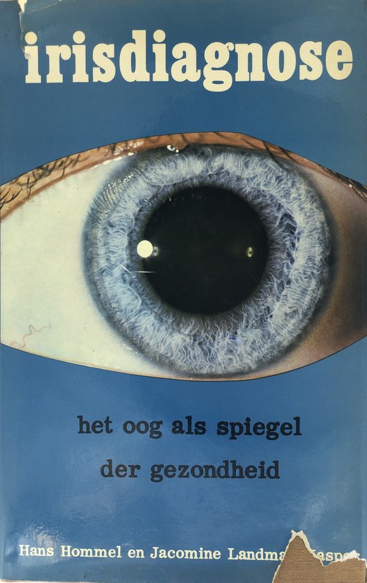 Irisdiagnose