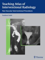 Teaching Atlas Series - Teaching Atlas of Interventional Radiology