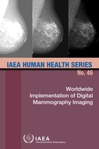IAEA Human Health Series 46 - Worldwide Implementation of Digital Mammography Imaging