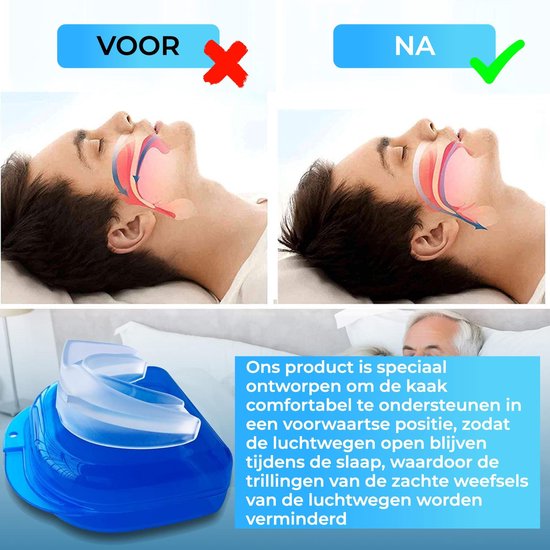 Solutize Embout buccal anti ronflement - produits anti ronflement -  dilatateur nasal... | bol.com