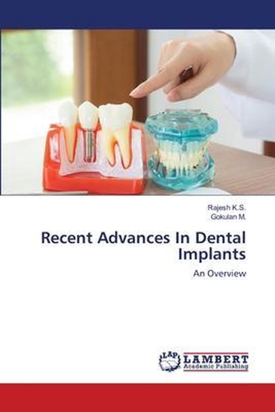 Recent Advances In Dental Implants 9786203462883 Rajesh K S