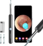 BeBird® Oorreiniger Oorsmeer Verwijderaar - Zwart- Oorsmeerverwijderaar Met 1080HD Draadloze,  Wifi-Oorcamera En LED-Lampjes, Oorspuit INCLUSIEF 4 OORTIP CAPSULE