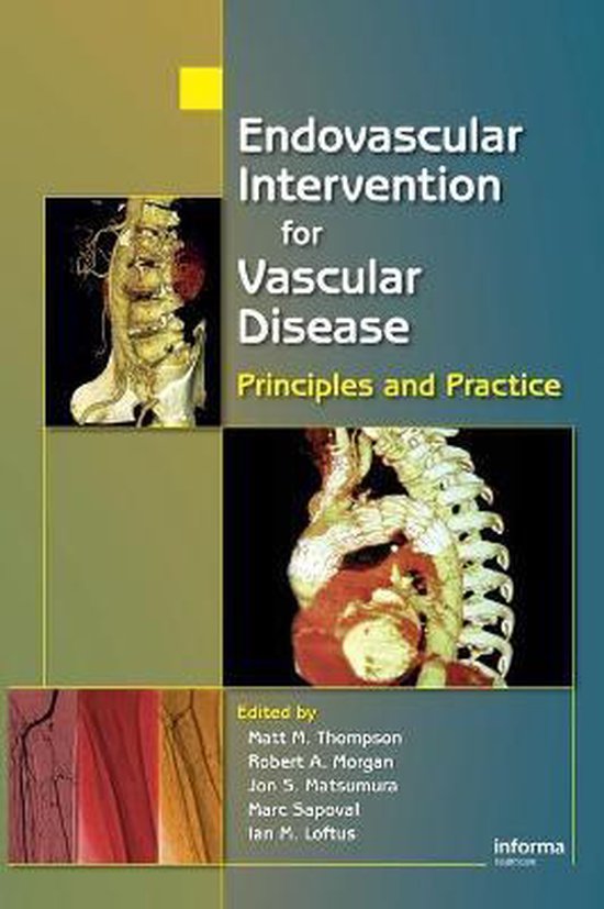 Endovascular Intervention for Vascular Disease - cover