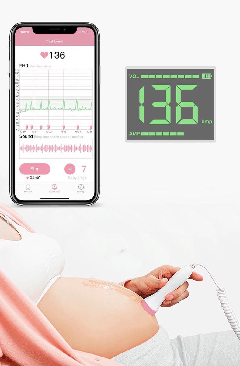 Bol Com Babyfi Multifunctionele Doppler Met App Inclusief Usb Kabel En Batterij