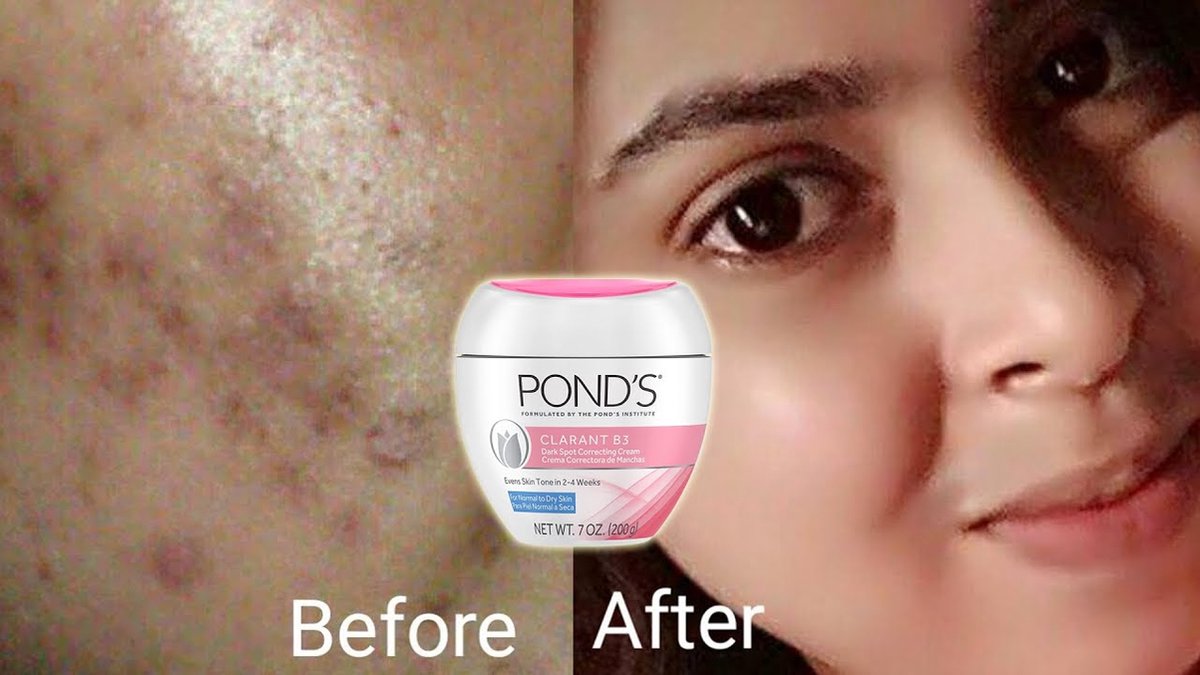 Pond's Clarant B3 Dark Spot Correcting Cream Day Cream Dark Spots Pigment Spots... bol