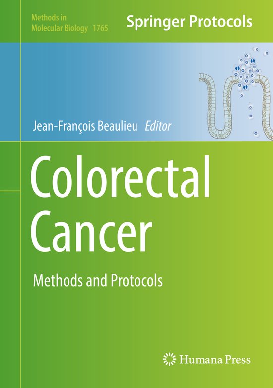 Foto: Methods in molecular biology colorectal cancer