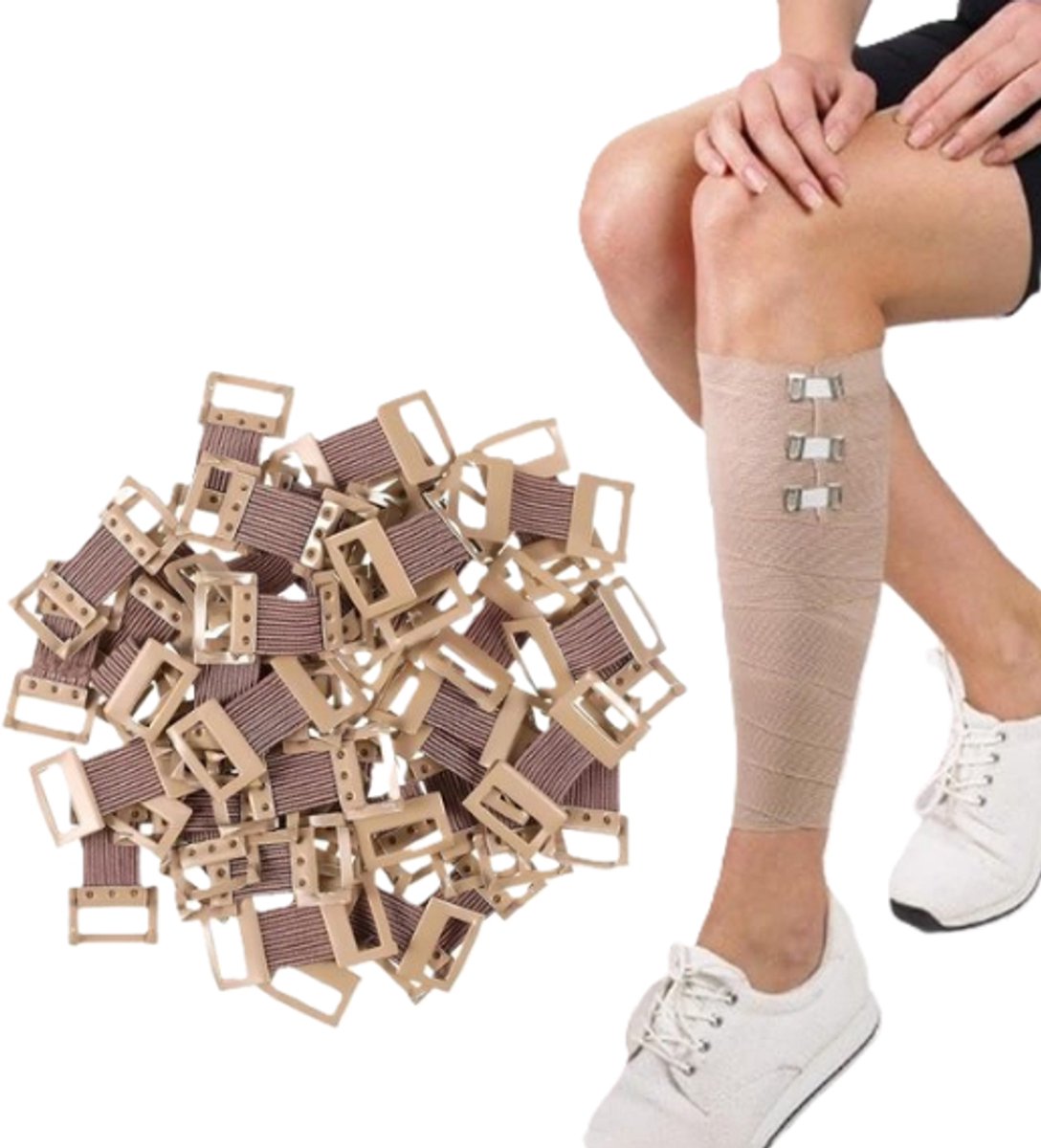 50 Stuks Verbandklemmen - bandageclips - elastisch - stretchbandageclip - stretch - klemmen - bandage wrap clips - verschillende verbanden - LOUZIR